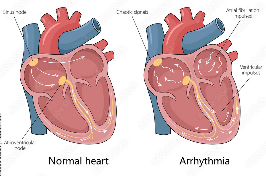 Cardiac Electrophysiology