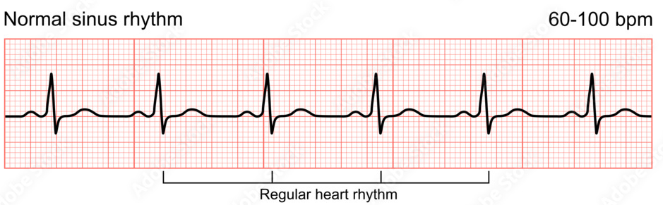 Cardiac Electrophysiology